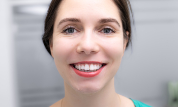 Zubní fasete: Vše, co potřebujete vědět o tomto zákroku pro dokonalý úsměv