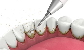 Domácí péče a dentální hygiena pro krásný úsměv