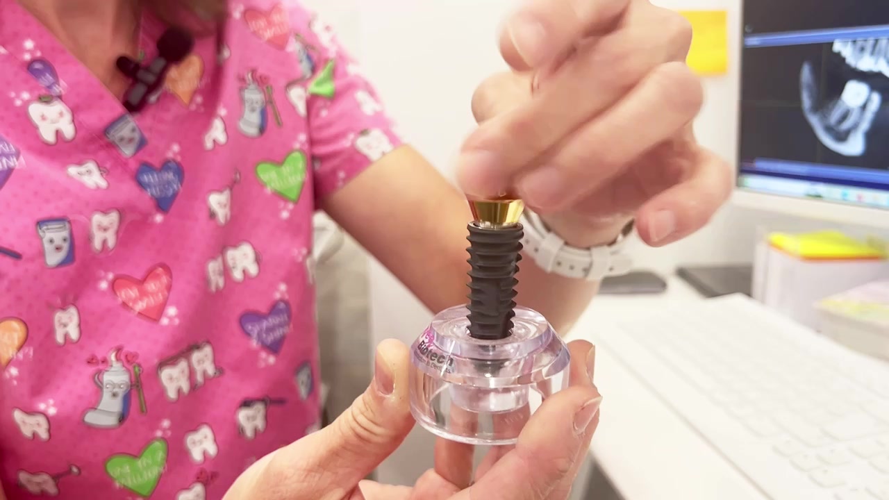 Dentální implantáty - zubní náhrada