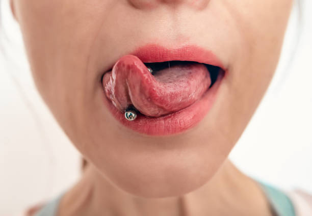 Jak piercing v jazyku ovlivňuje zdraví Vašich zubů