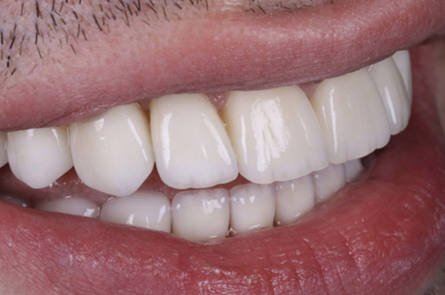Dentální hygiena
