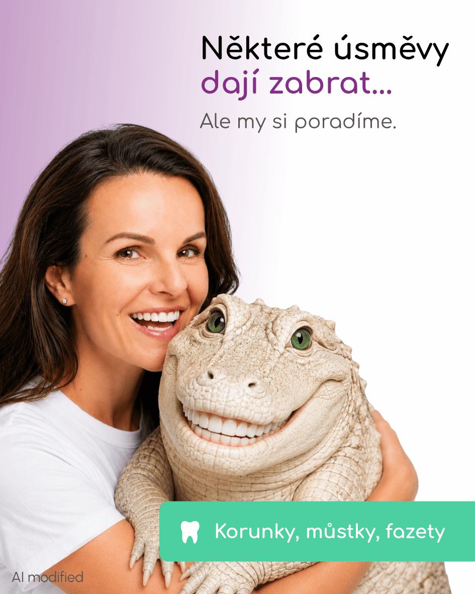korunky a fazety - estetická stomatologie Smile Centrum
